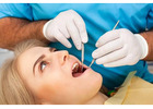 Wisdom Teeth Removal Gold Coast – Professional Dental Care